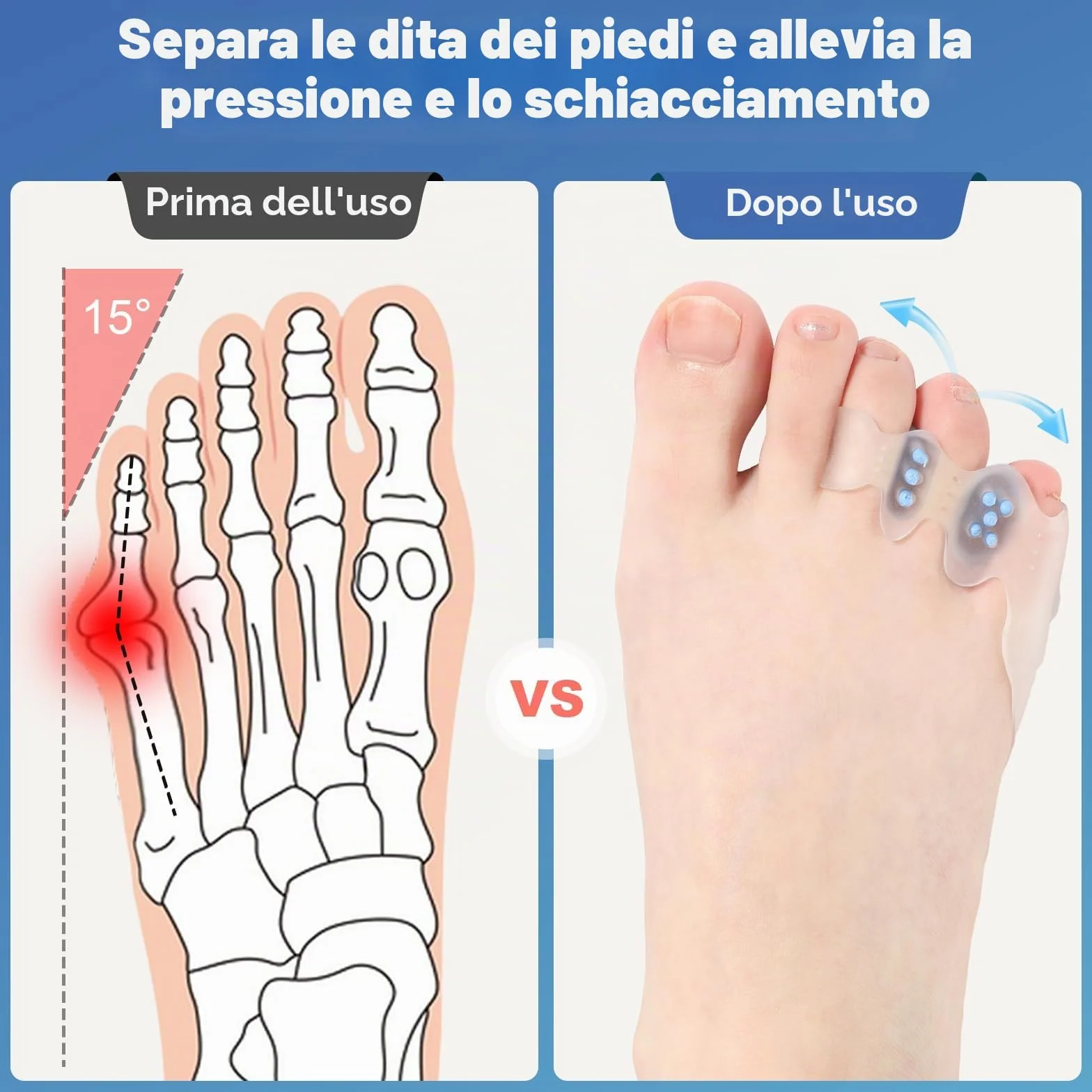 Correttore alluce valgo protezione mignolo raddrizzatore dita arricciate storte separatori dita sovrapposte sollievo dolore