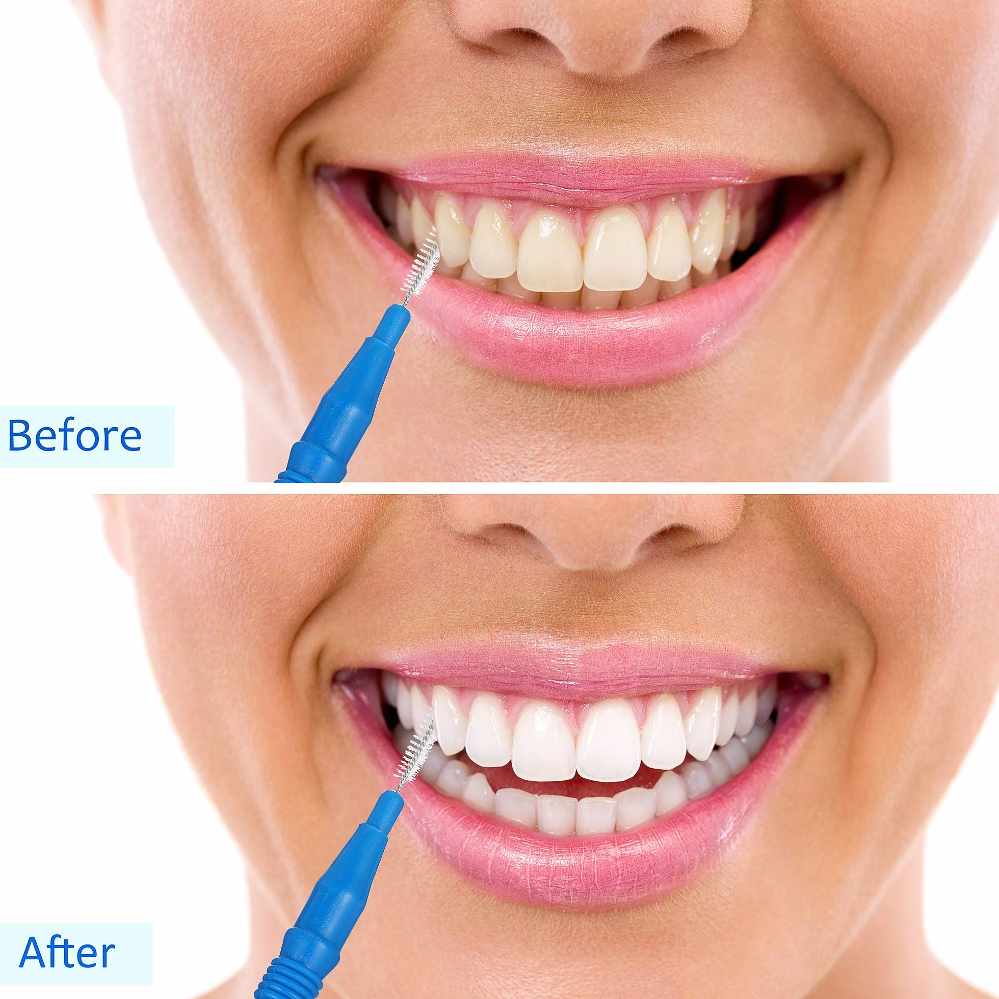 Spazzolino Interdentale Stuzzicadenti Dentali Flosser 100 Pezzi Igiene Orale Strumento (Rosso, Blu)