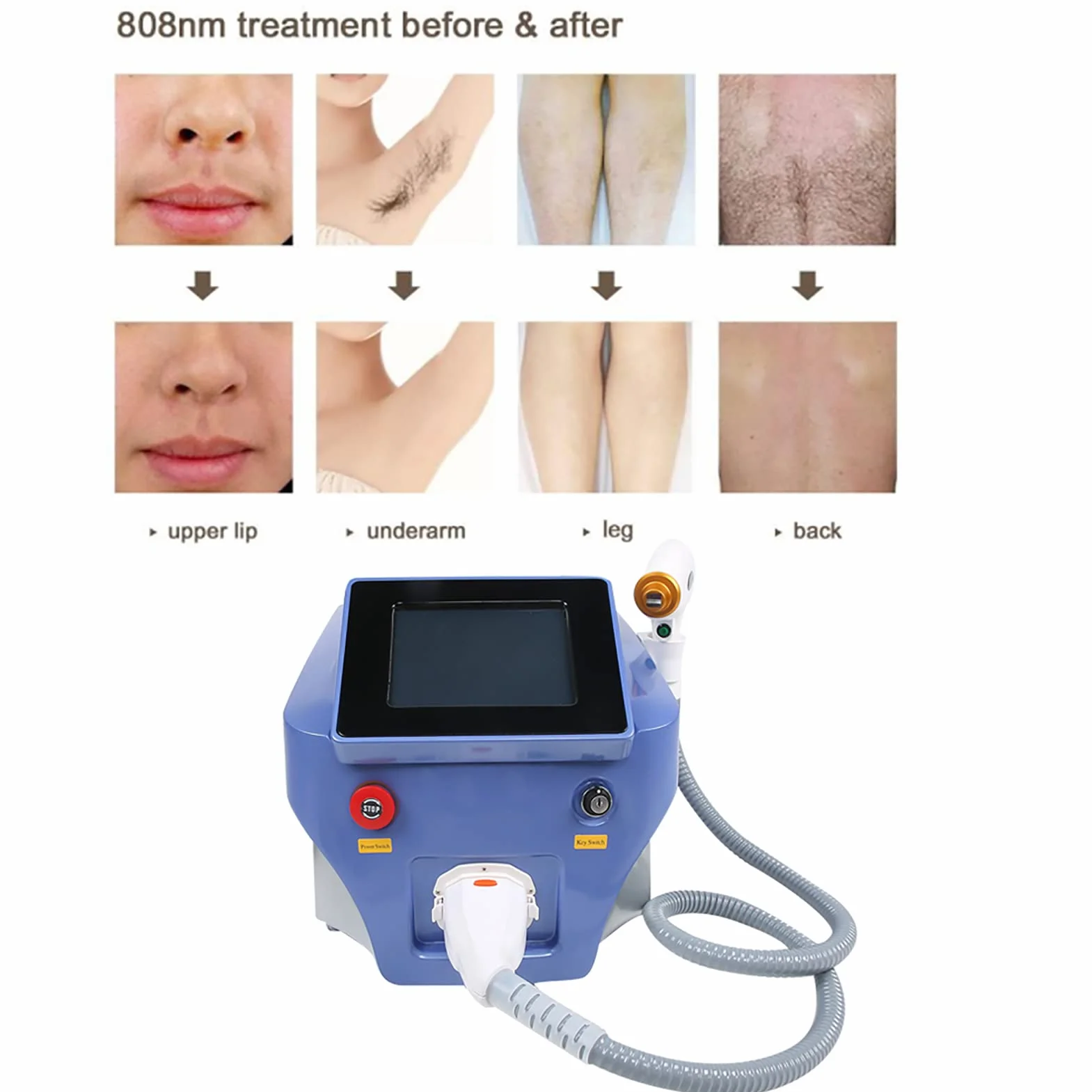 Macchina per la Depilazione, Epilatore Facciale Professionale per il Corpo con 3 Lunghezze D'onda, Macchina per la Depilazione Permanente con Laser a Diodi 808 per Donne e Uomini