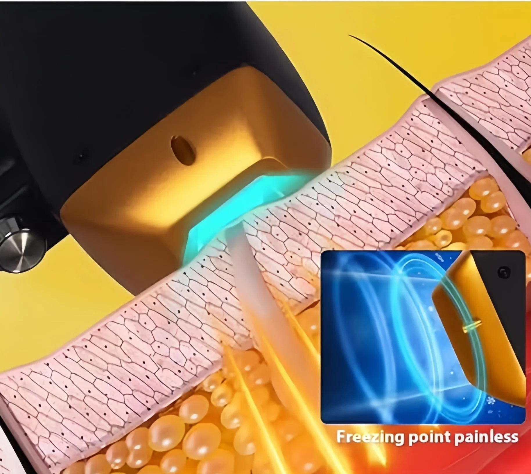 Professional diodo ghiaccio titanio laser corpo depilatore 808nm 755nm 940nm 1064nm 4 onde depilatore permanente attrezzatura CE donna
