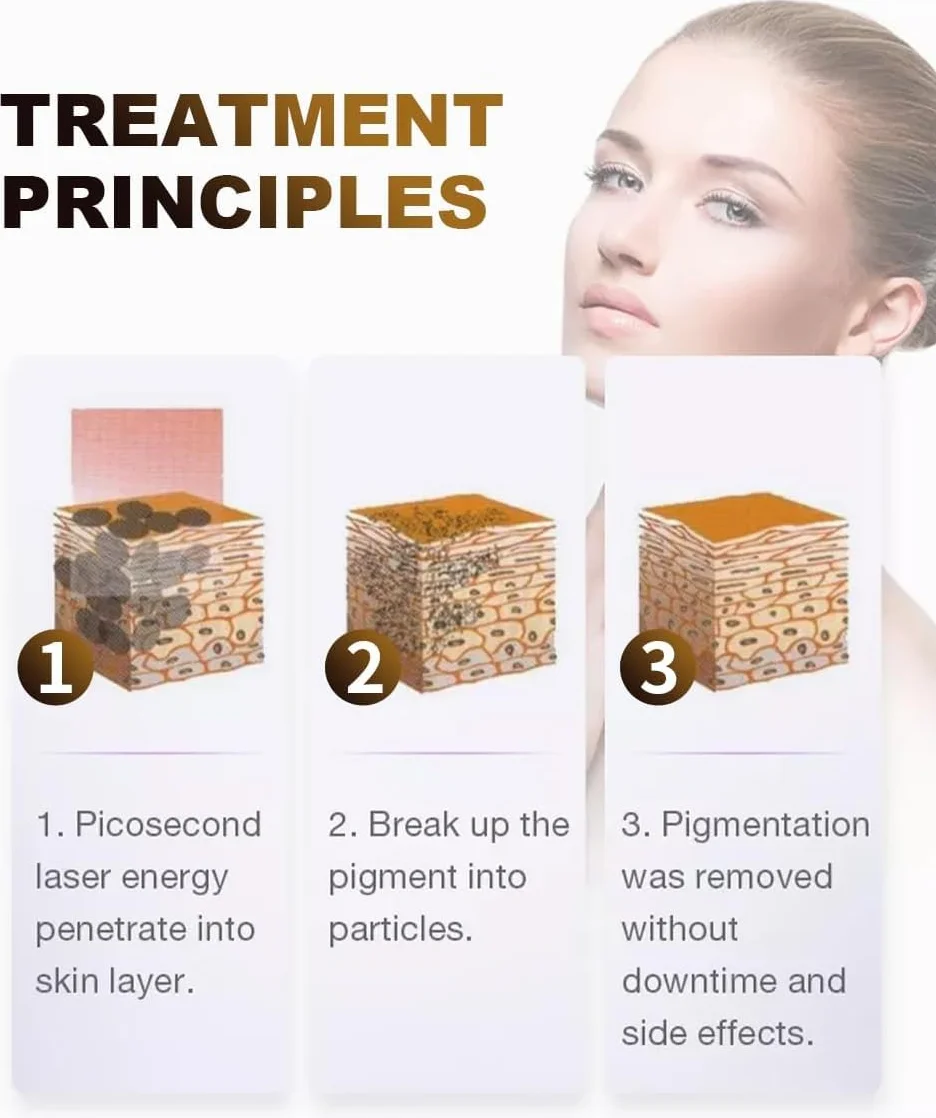 Professional 808nm diodo laser epilatore picosecond 2 in 1 ghiaccio titanio laser epilatore e rimozione tatuaggio, adatto per uso in salone di bellezza