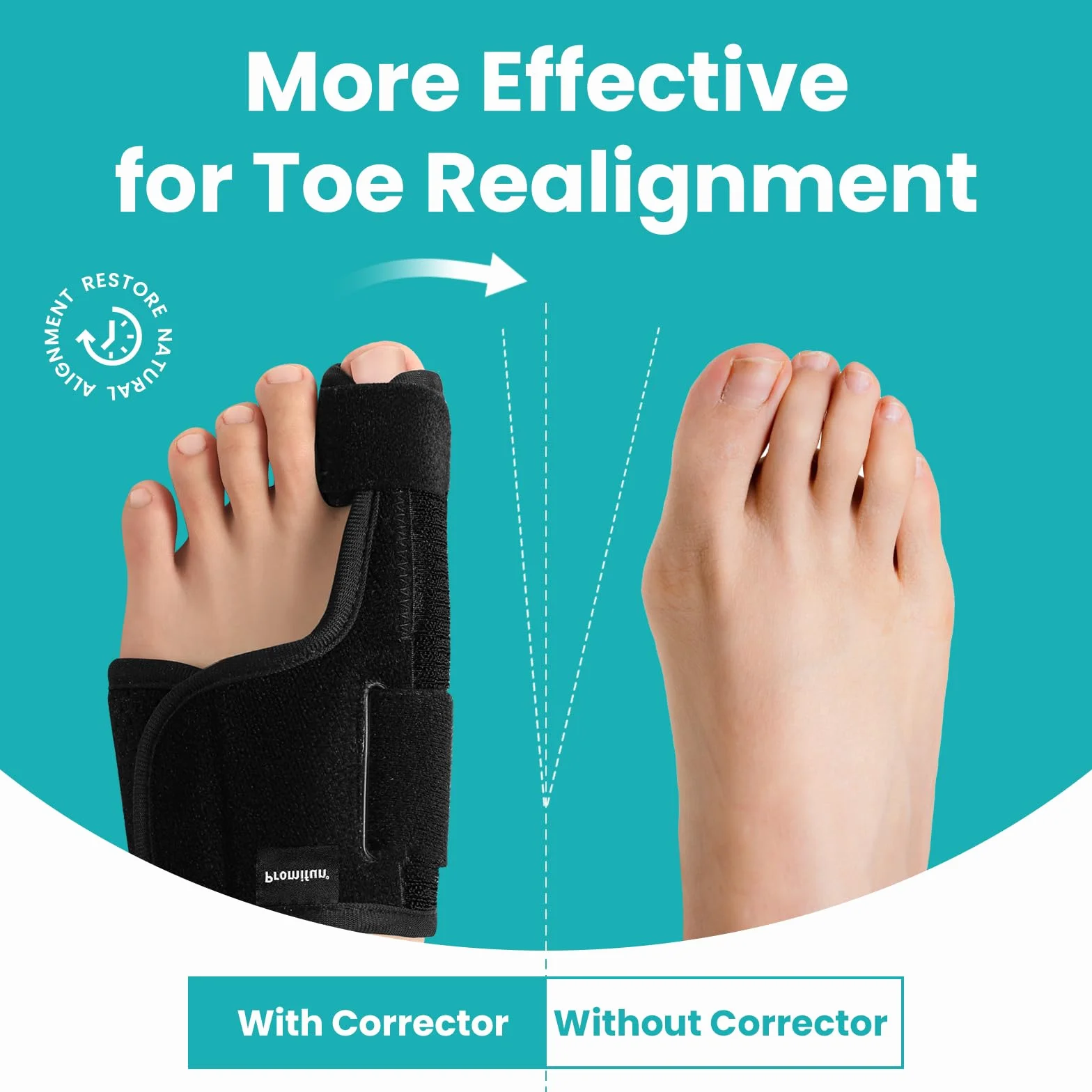 Promifun Toe Splint for Broken Toes – Big Toe Splint Support Brace for Women & Men – Bunion Corrector – 1 Pair