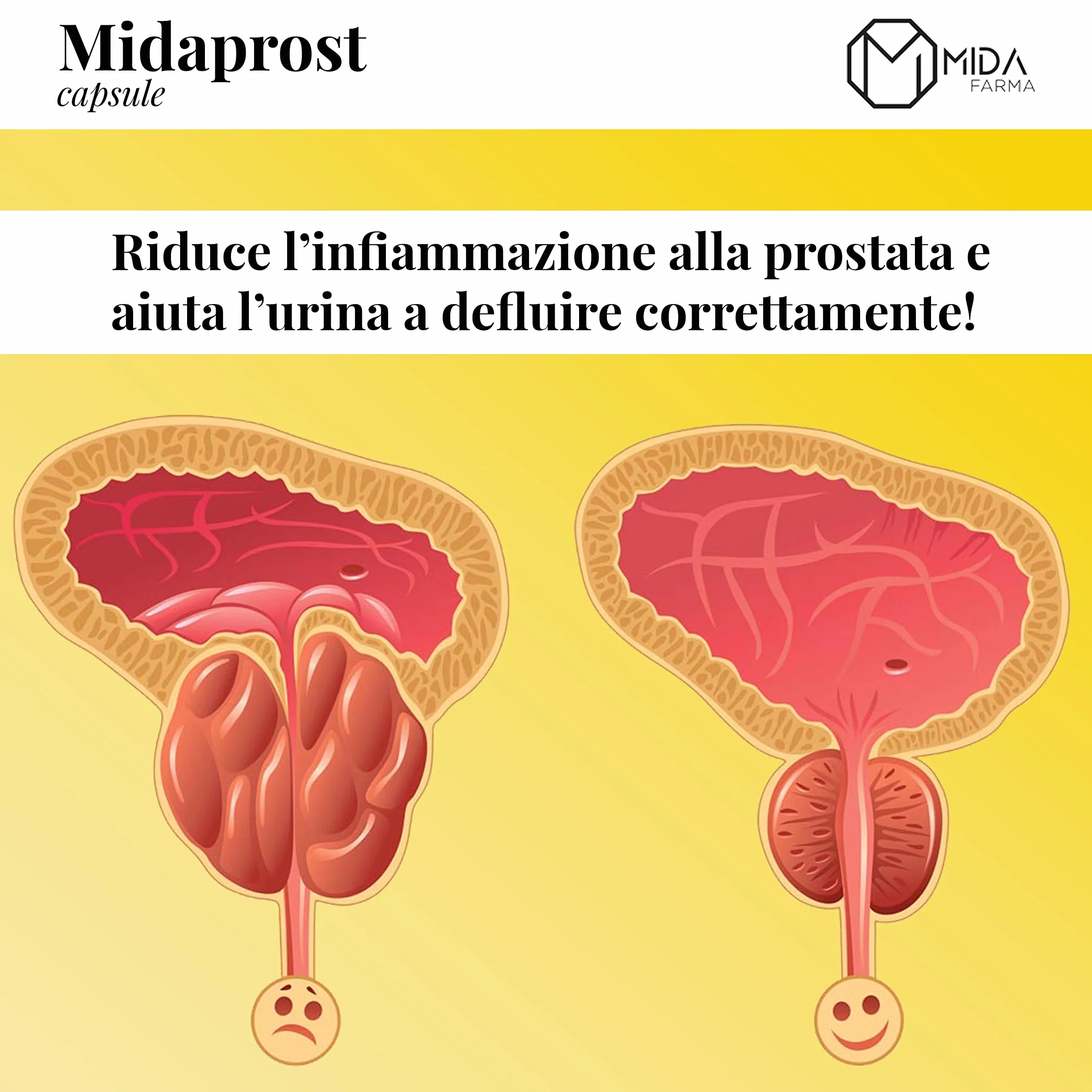 MIDAPROST Serenoa Repens Saw Palmetto 320 mg Tè Verde Magnesio 30 Capsule Prostata Ingrossata Ipertrofia Prostatica Benigna Prostatite