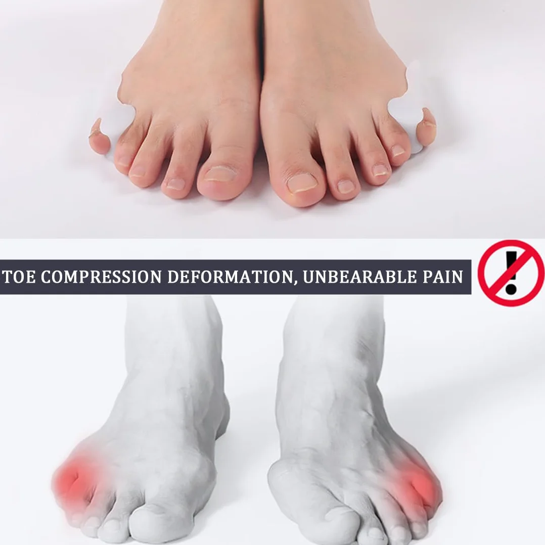Alluce Valgo Correttore, Protezione Piccolo Dita, Separatore Dita Piede in Silicone per Camminare, Correre e Danza