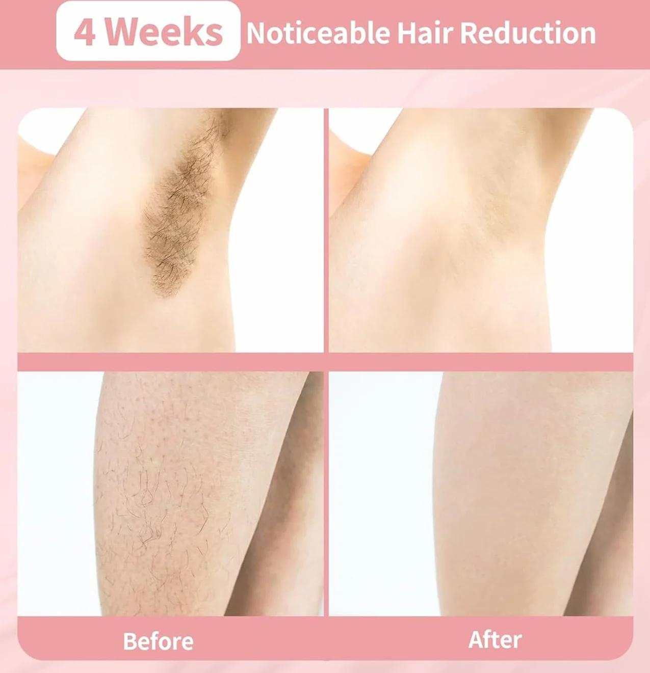 Dispositivo di epilazione laser a diodo, rimozione indolore e permanente dei peli su tutto il corpo, adatto a viso, braccia, gambe e zona bikini, unisex