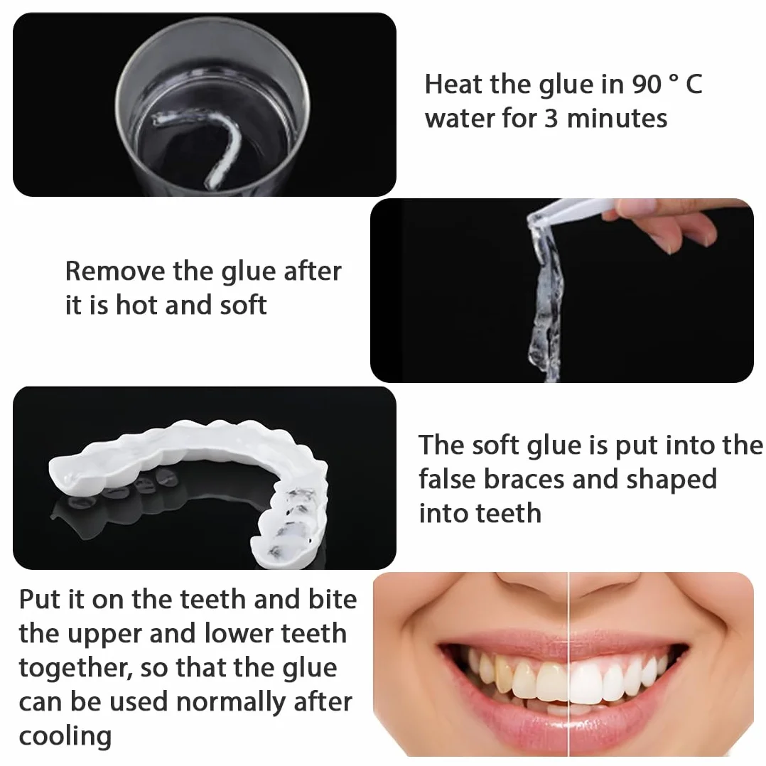 Faccette Denti Finti a Scatto Superiore e Inferiore, Protesi Dentarie Cosmetiche Temporanee