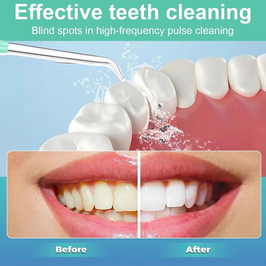 8 pezzi Ricambio Punte Spruzzo Dentario Acqua Idropulsore Ugello Accessori per Waterpik idropulsore dentale e Altri Irrigatori Orali