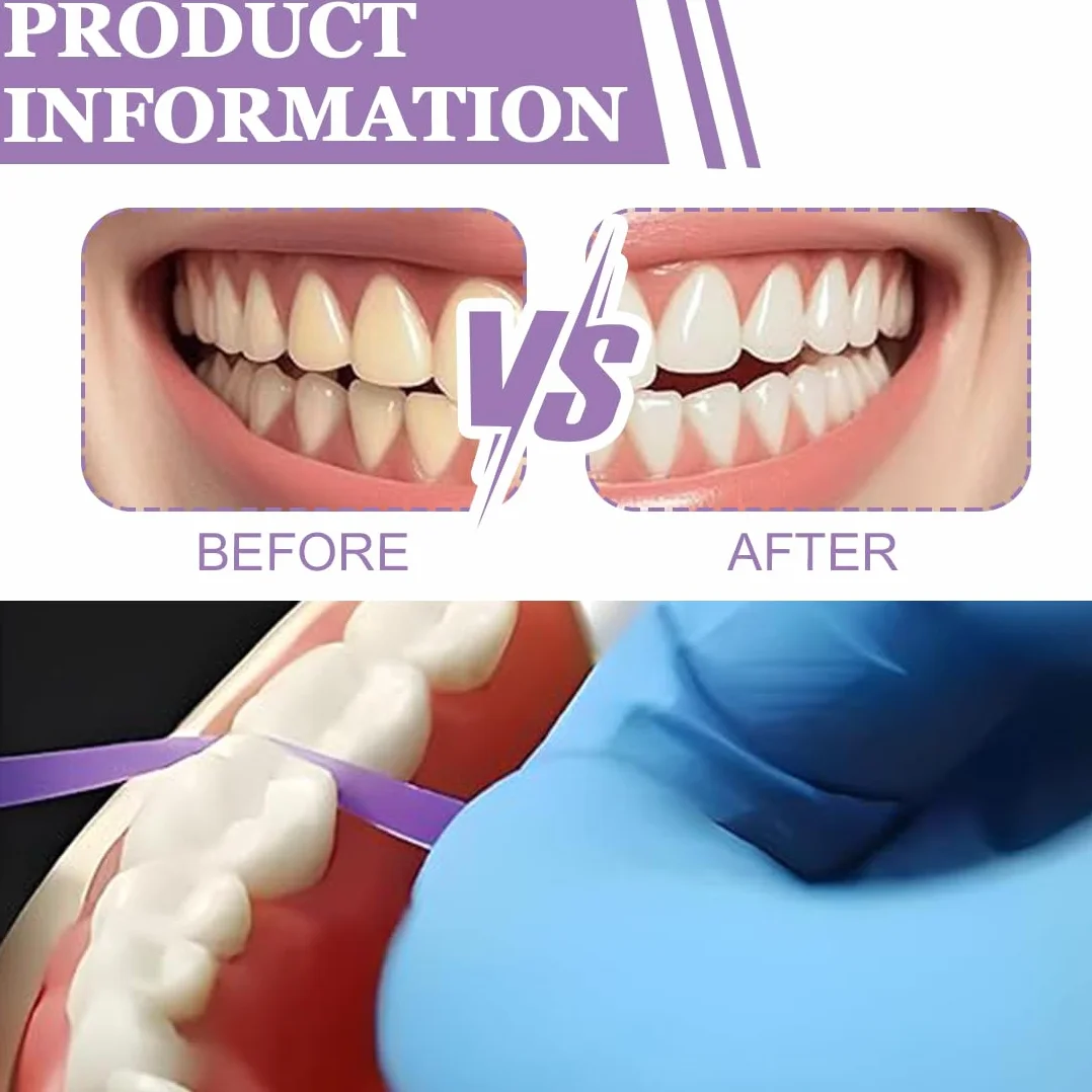1 Roll 50 Μm Interdental Abrasive Strips Dental Box Polishing Strip Abrasive Paper For Teeth Whitening Strips Strisce Sbiancanti Denti For Sanding Cleaning Interdental Teeth 4 Mm X 6 M