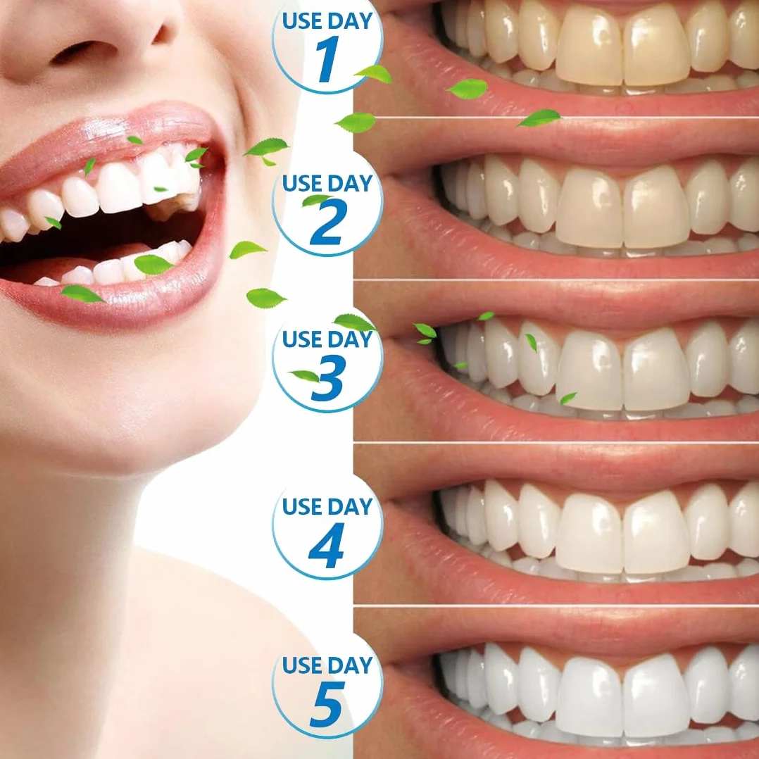 Strisce Sbiancanti Denti Professionale - 28 Strips Whitening per Sbiancamento,strisce sbiancanti denti, Delicate e Rapide, Rimuove le Macchie Profonde-A