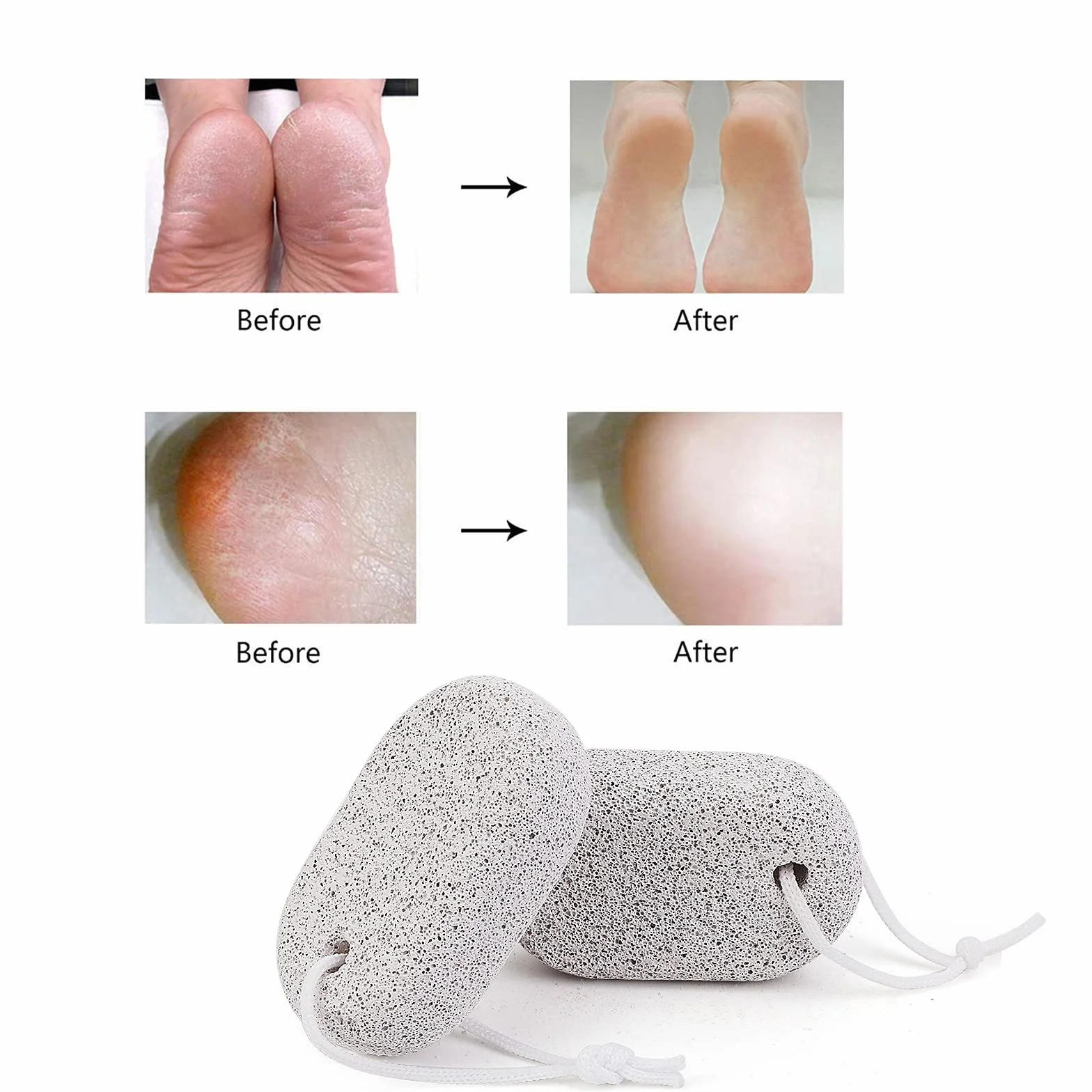 Pietra Pomice Naturale per Piedi 3 Pezzi, Lava Pedicure Tools Rimozione Callo Pelle Dura Esfoliazione Piede