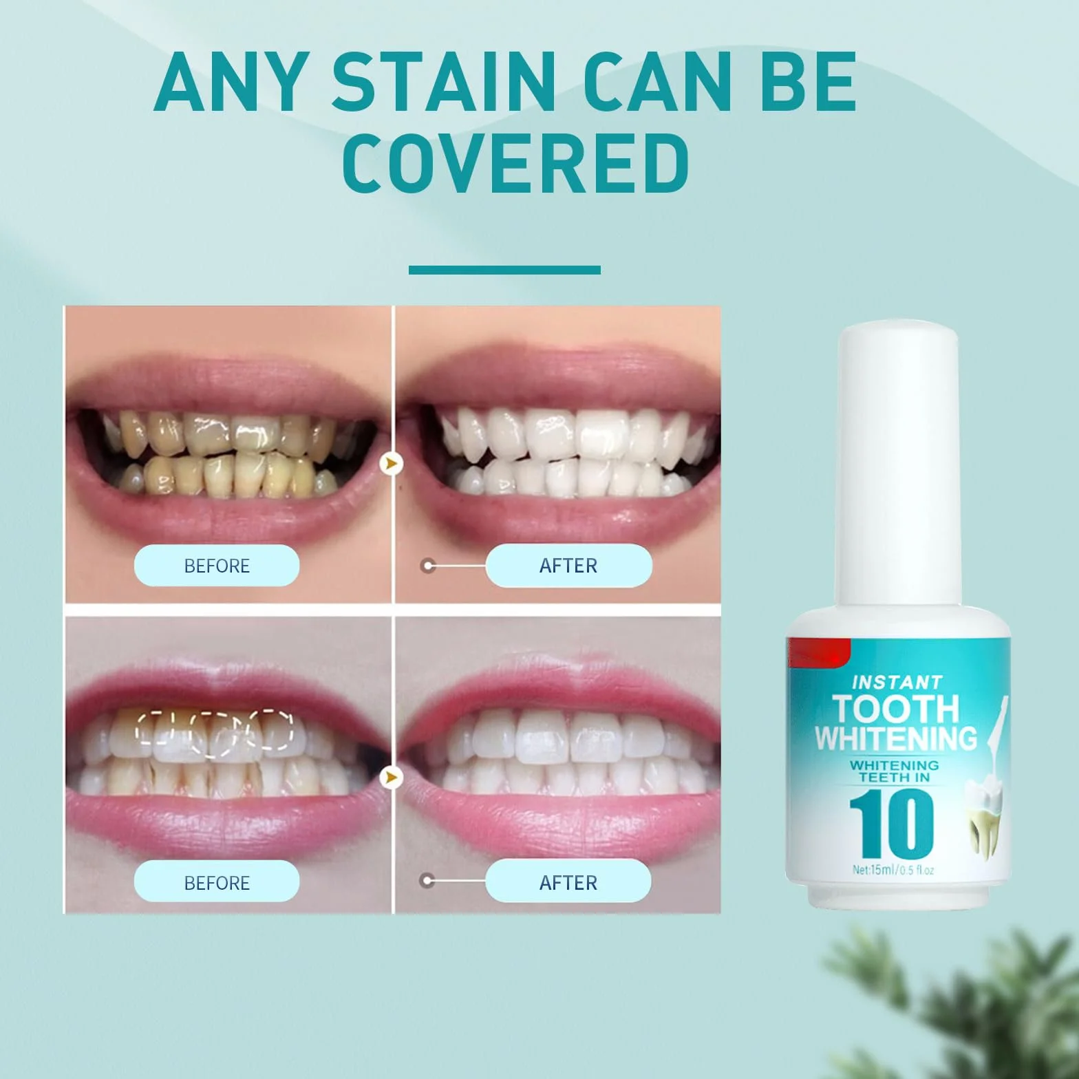 Vernice Sbiancante per Denti, Gel Sbiancante, Smalto Bianco per Denti Sensibili