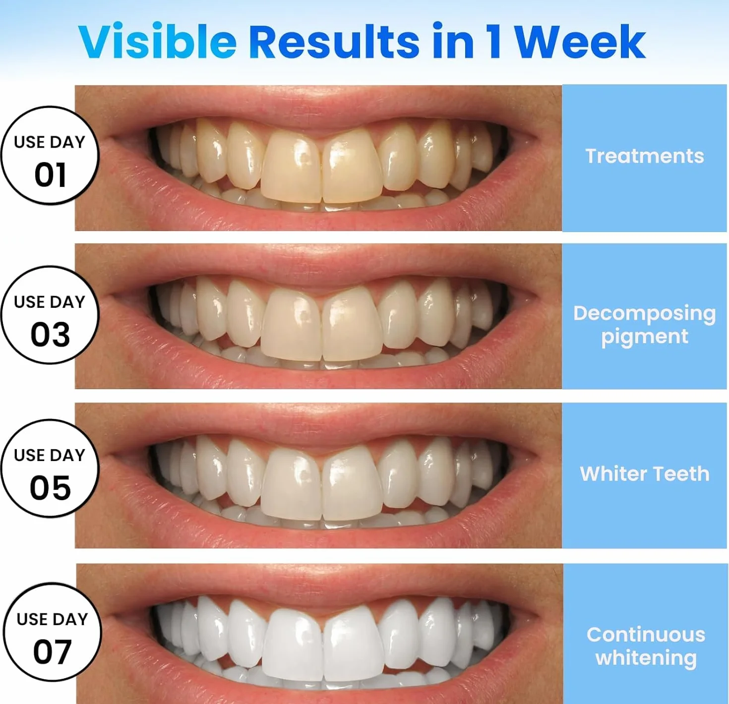 strisce sbiancante denti professionale sbiancanti denti - 28 strisce sbiancanti 14 Sessioni sbianca denti striscia sbiancante denti teeth whitening strips per sbiancamento denti Sicuro per Smalto