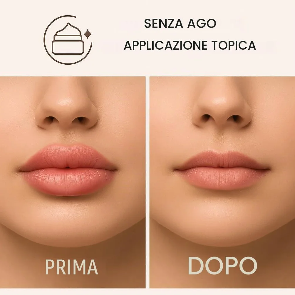 SoftFil Topilase Trattamento dermo-regolatore post filler 3 ml
