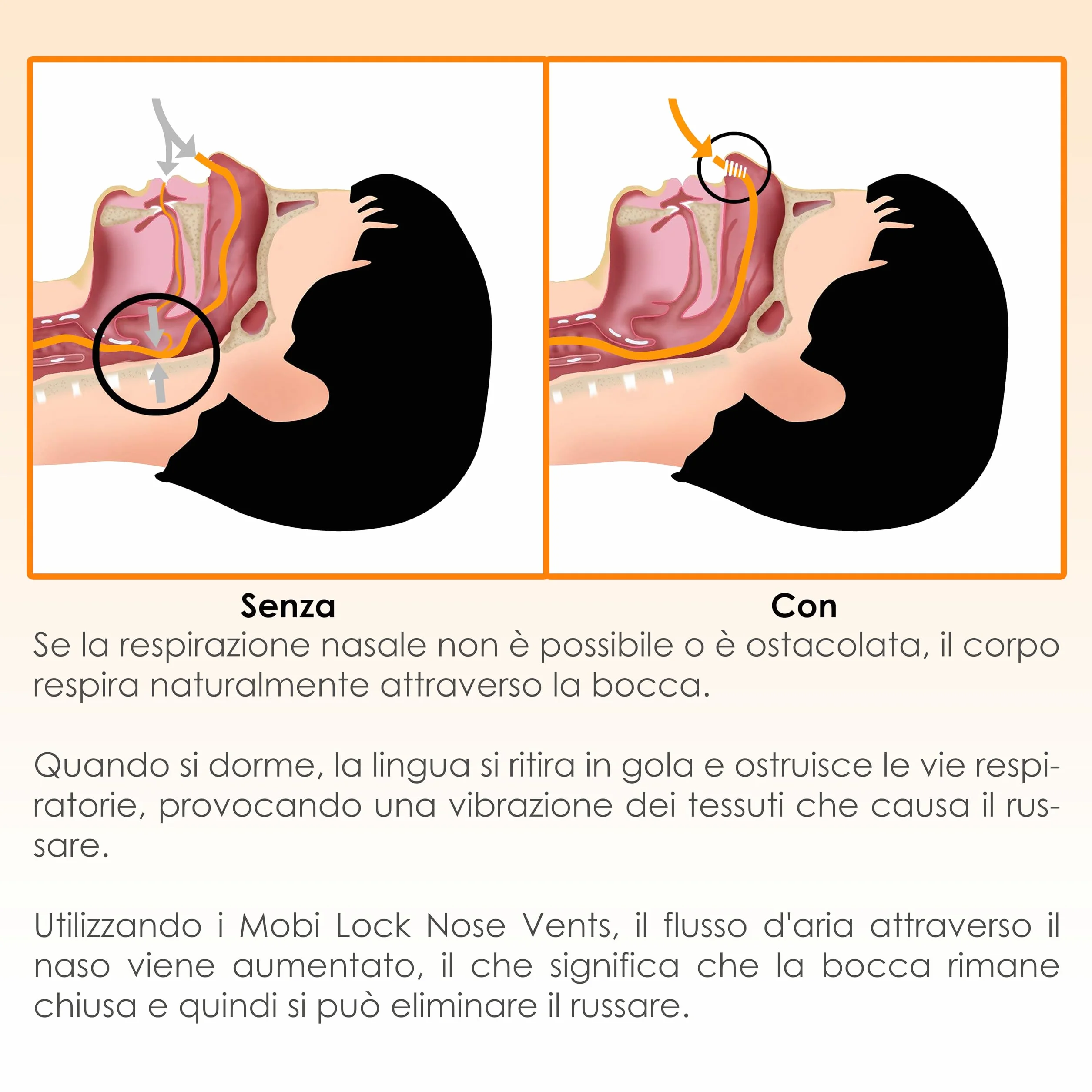 Dilatatore Nasale per Sollievo Sinusale Confezione da 12 Medio Bocchette Morbido Dispositivo Antirussamento Riutilizzabile