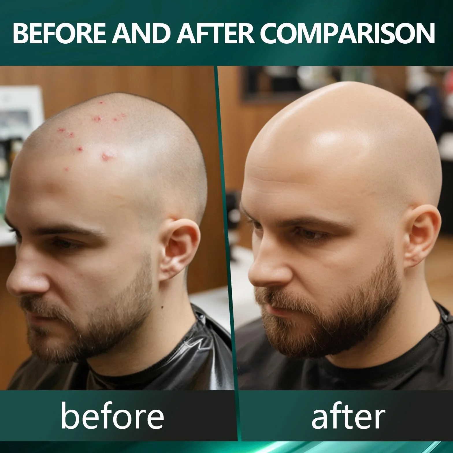 Crema Teste Rasate 50ml Idratante Lenitivo Nutriente Cura Cuoio Capelluto Dopo Rasatura Non Grassa Uomo Calvo
