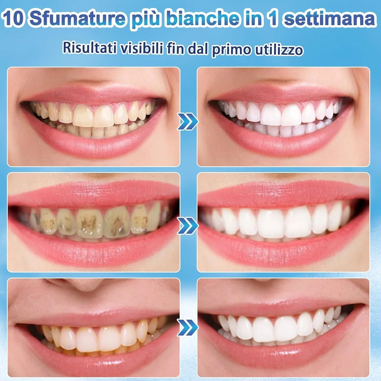 Penna Sbiancante Denti 4 Pezzi Kit Sbiancante Denti Immediato Gel Rimuove Macchie Ingiallimento