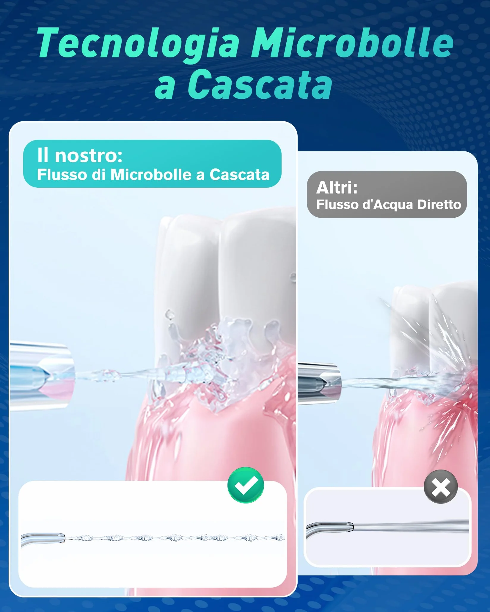 Vincitore del test Irrigatore Orale 2025, 4 Modalità, Senza Fili, Serbatoio 300 ml, 6 Punte a Getto di Pressione