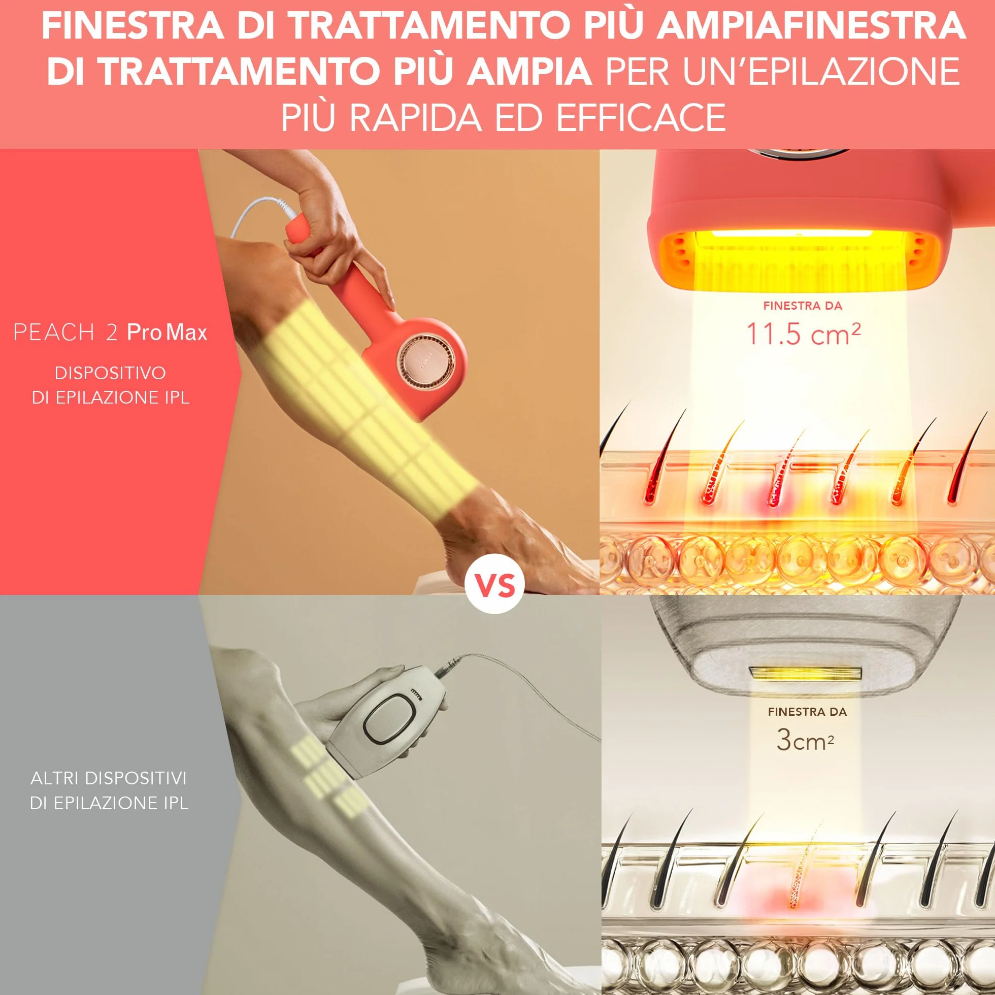 FOREO PEACH 2 Pro Max epilatore luce pulsata, depilatore corpo donna, uomo. Depilazione uomo, donna con epilazione IPL avanzata per viso, corpo. Pelle liscia, risultati duraturi