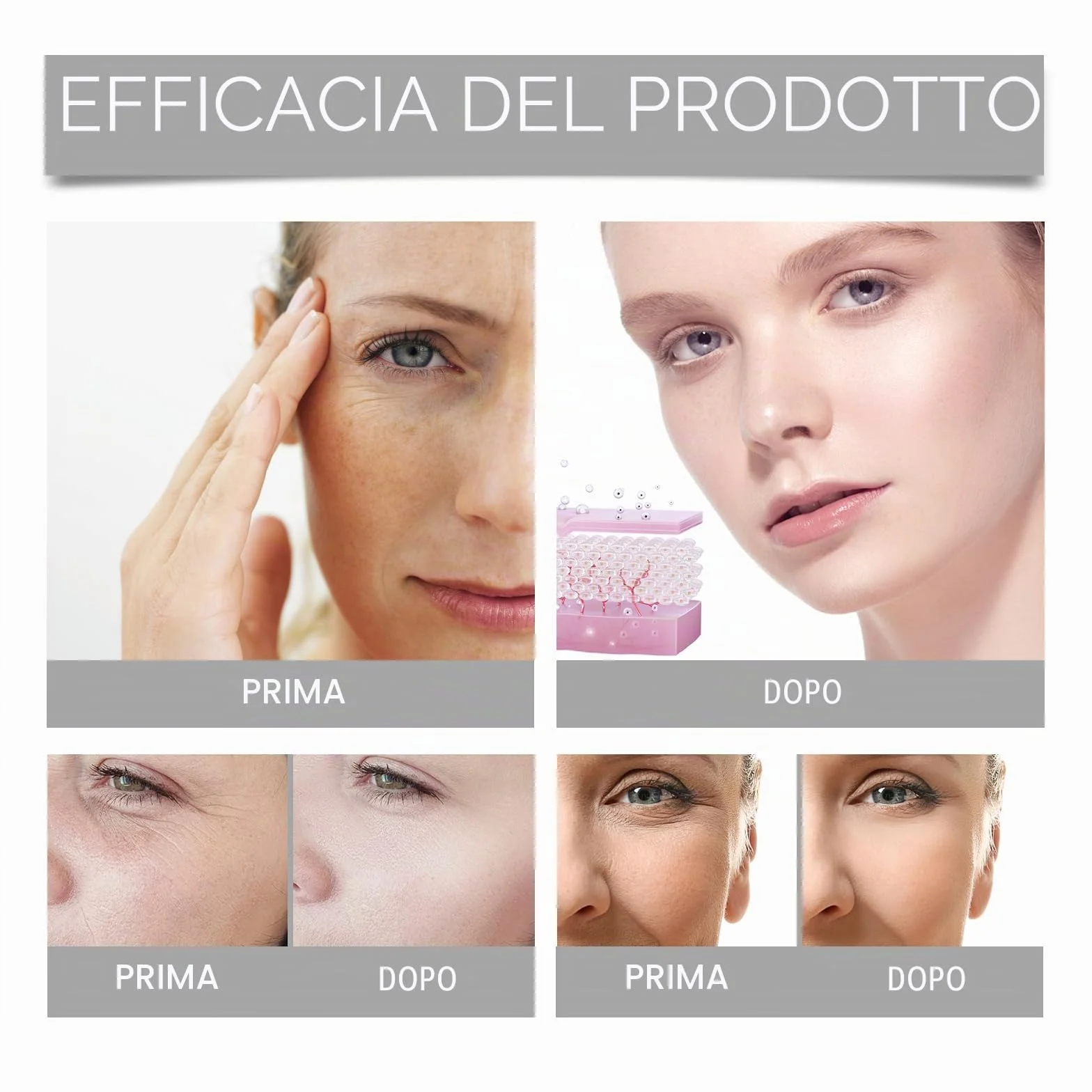 Sistema di Microinfusione Viso e Labbra con Acido Ialuronico Intensivo, Idratante e Antirughe