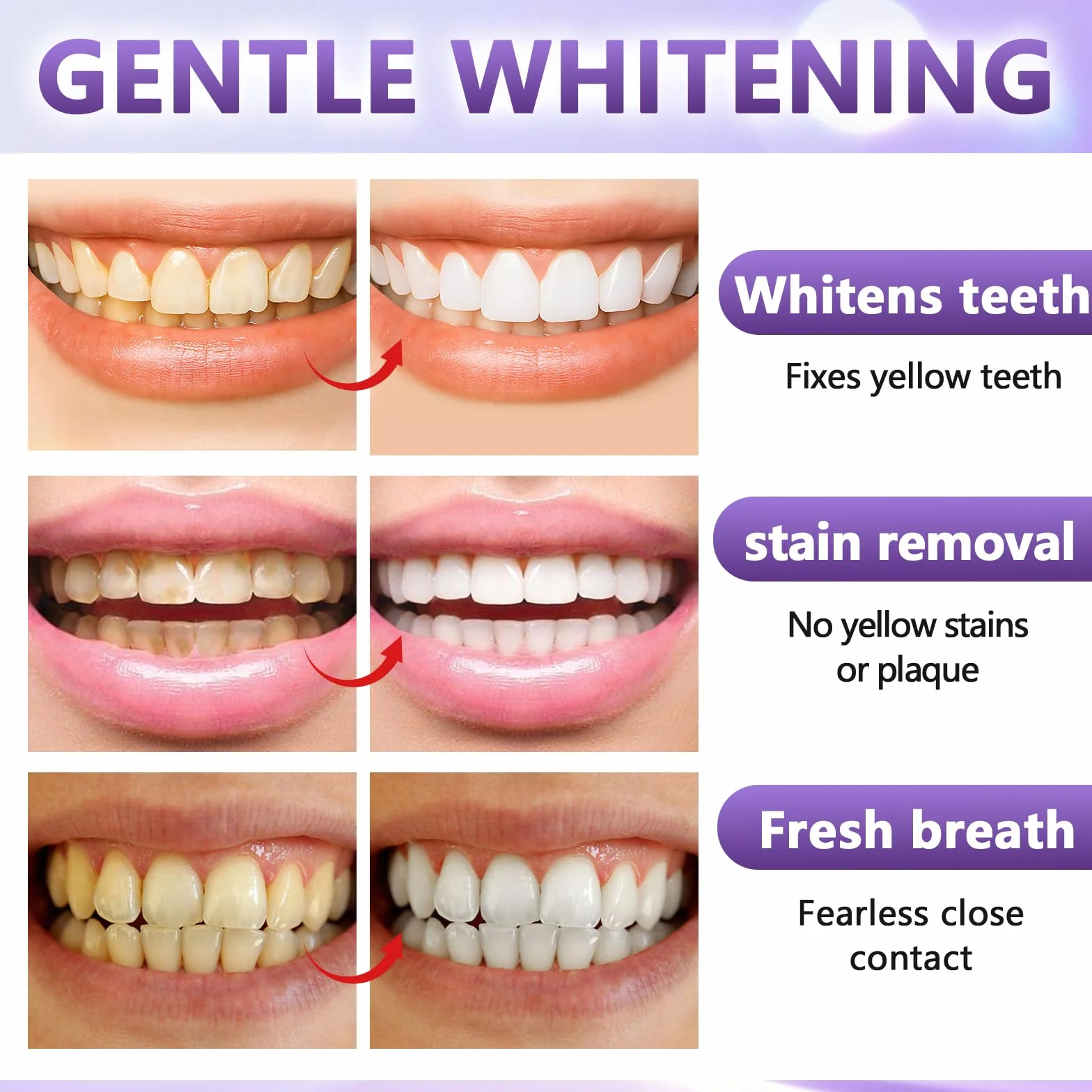 14 Paia Strisce Sbiancanti Denti Viola, Kit Sbiancamento Denti A Casa Senza, Antiscivolo Whitening Strips, Sbiancante Rapide Bianche Teeth, Facile Uso A Casa O In Viaggio