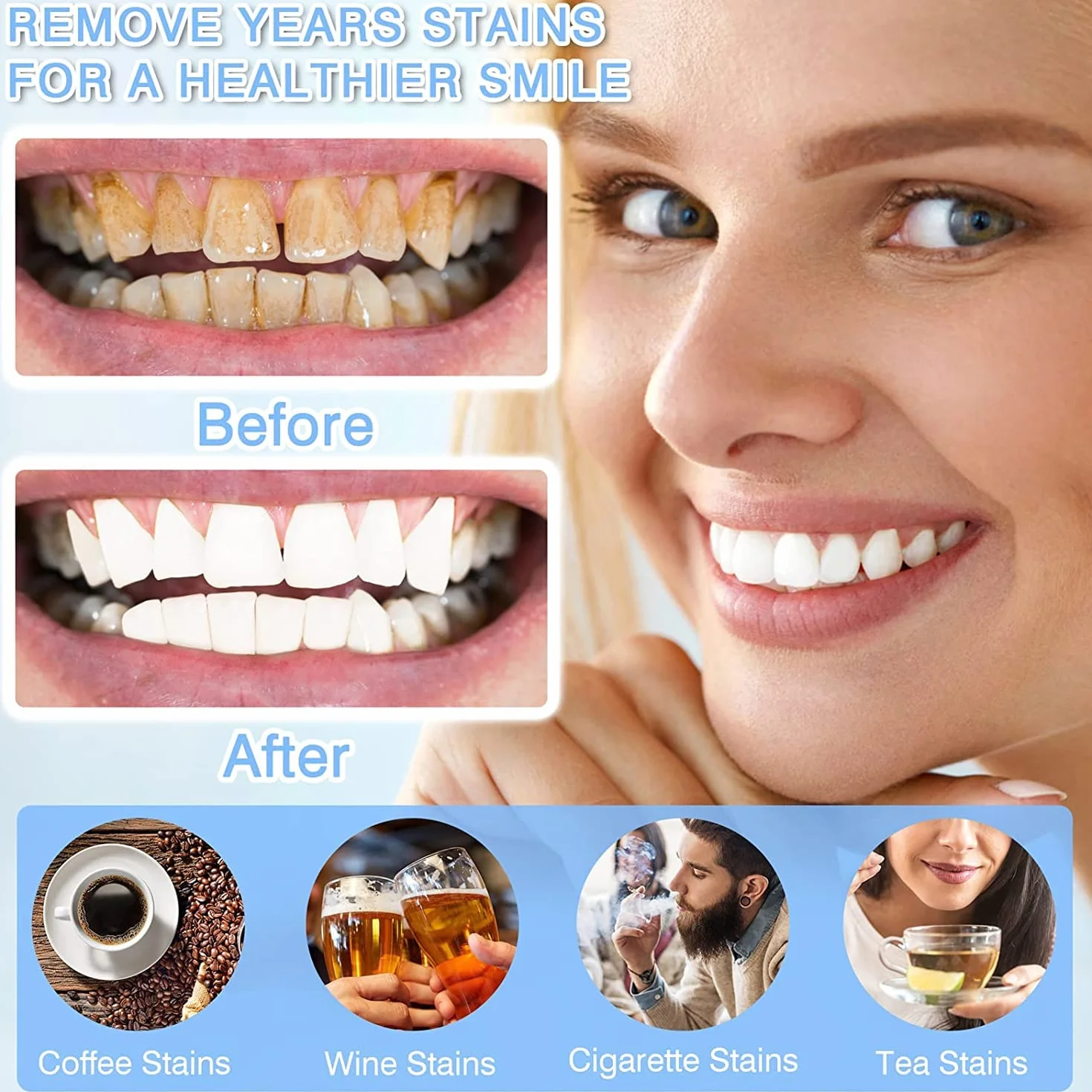 Kit Sbiancamento Denti Professionale LED 10x3ML Gel Sbiancante