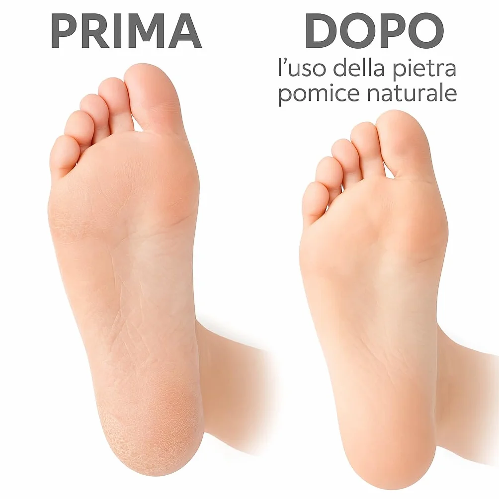 Pietre Pomice Naturali Ovali 9×6×3 cm Rimuovi Calli Piedi Mani Delicate Efficaci