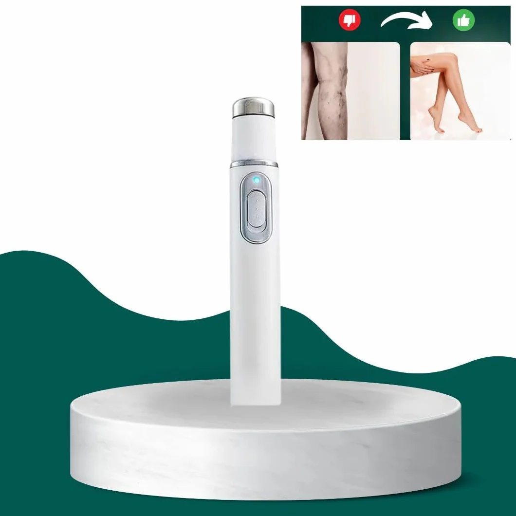 Generico Dispositivo Non Invasivo per Il Trattamento delle Vene Varicose, Apparecchiatura Laser per Il Trattamento delle Vene Varicose, Dispositivo Laser per Vene Varicose A Domicilio (1x - Single)