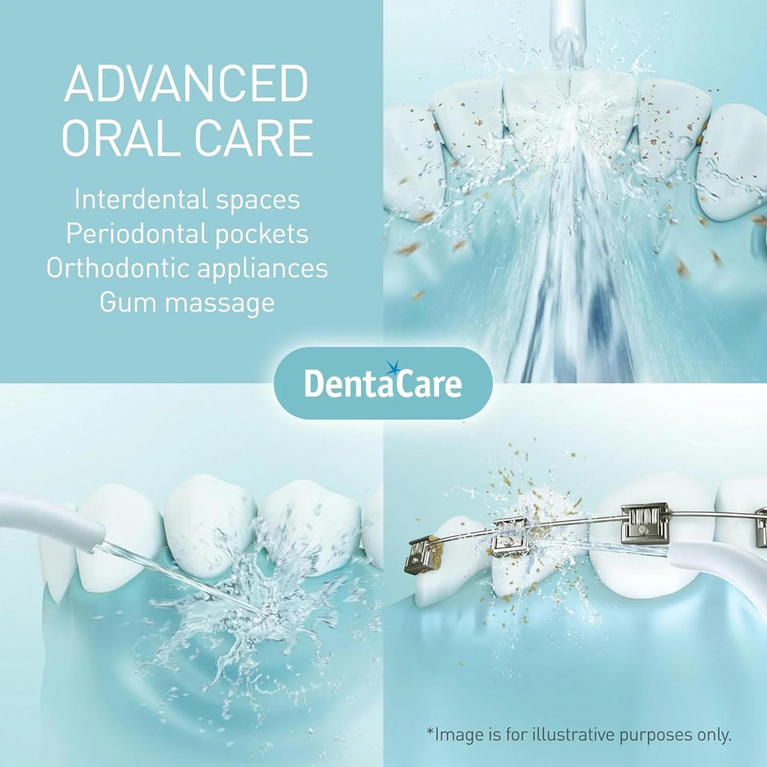 Ugelli di Ricambio per Sciaccatori Dentali, Accessori Irrigatori Orali Compatibili