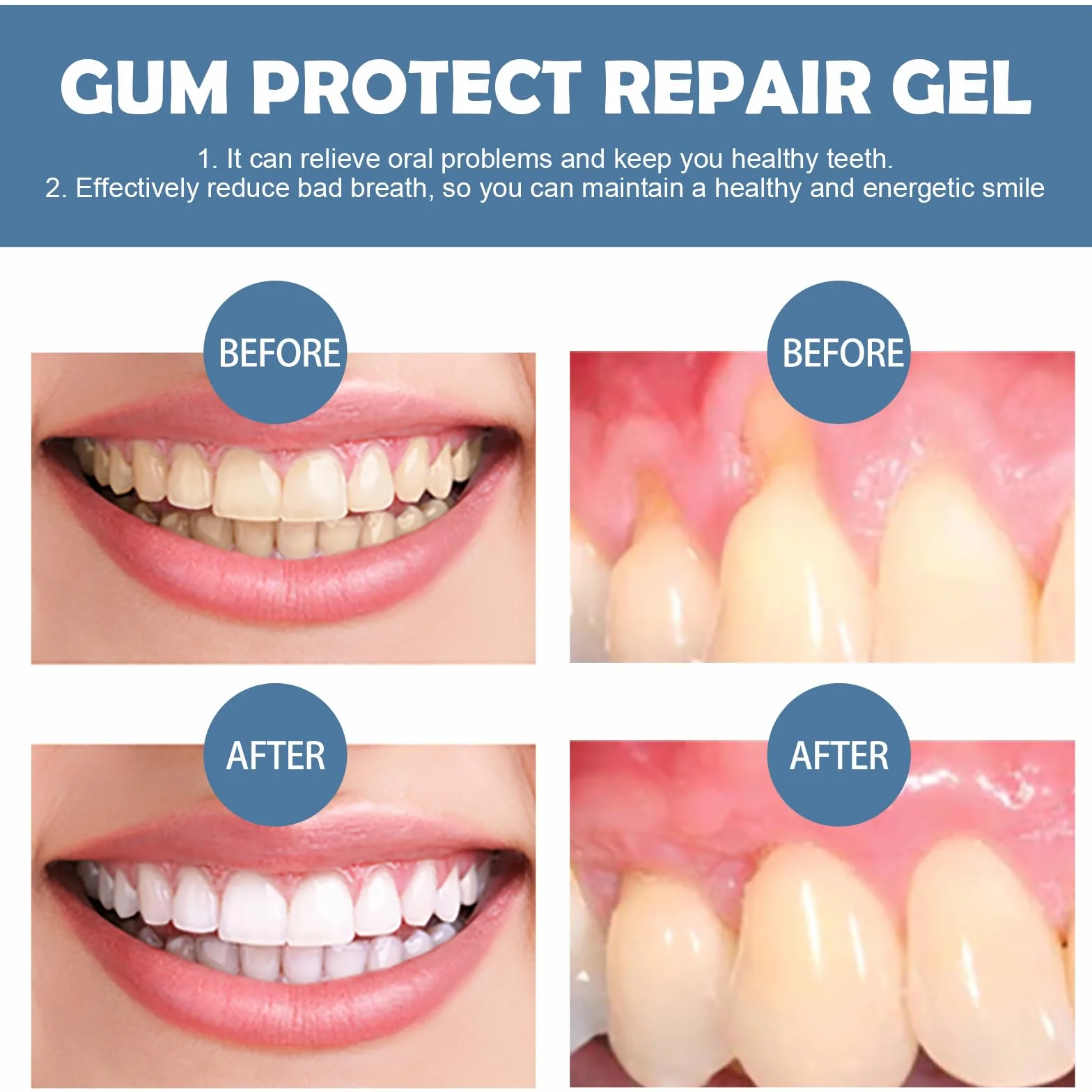 Kit Sbiancante Denti 4PC Gel per Denti Bianchi